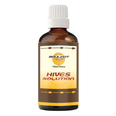 Hives Solution